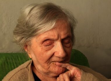 alzheimerjeva bolezen demenca