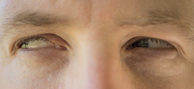 medosebni odnosi zavidanje rok terkaj